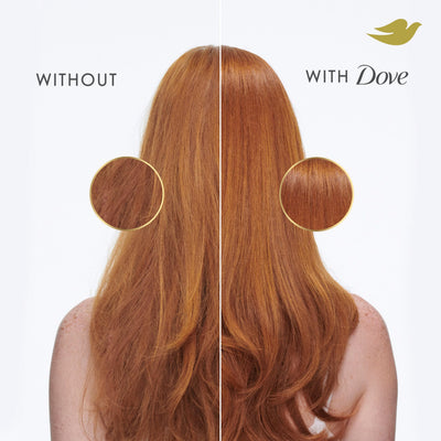 Dove Shampoo Intensive Repair for Damaged Hair with Bio-Protein Care Technology and Amino Serum 28 Fl Oz